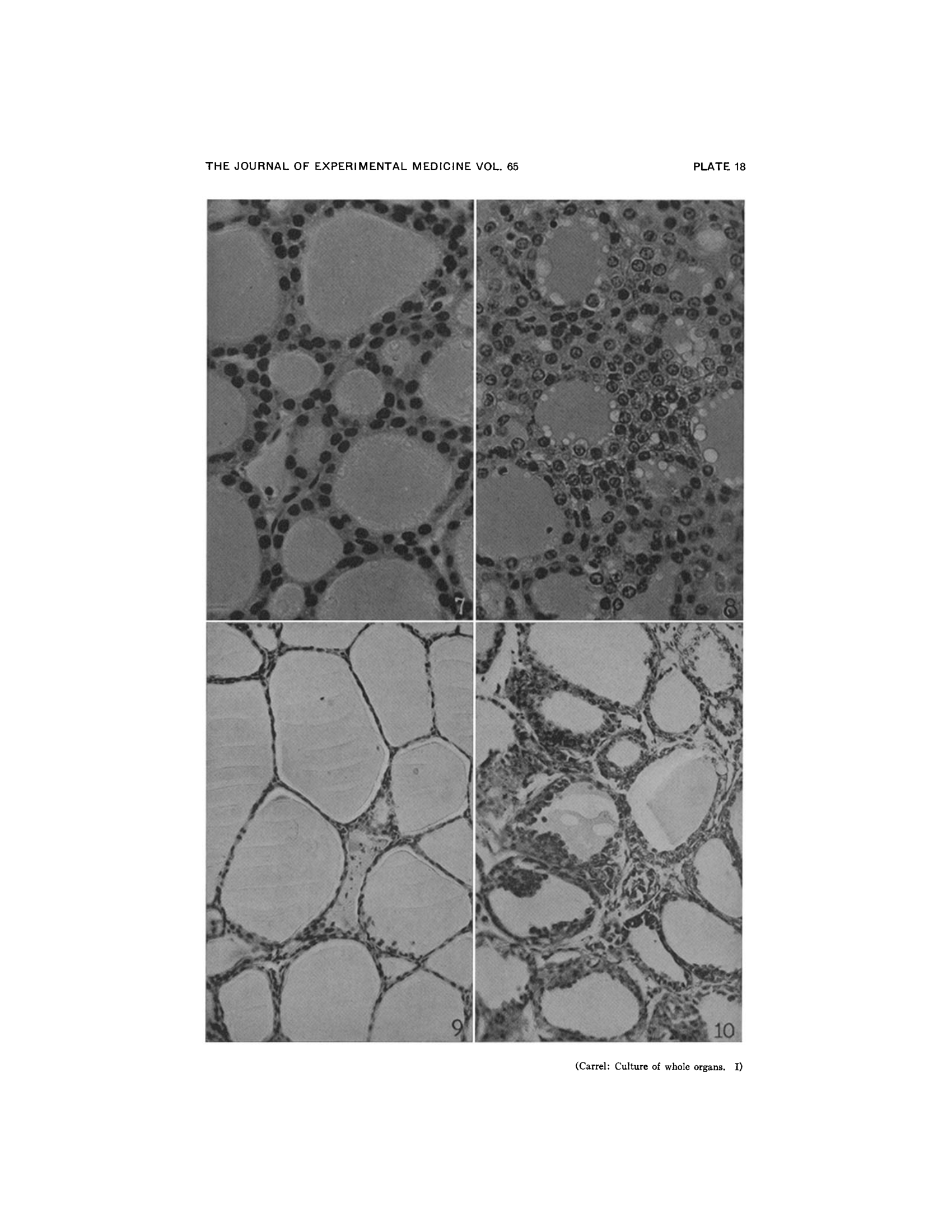 Hyperplasia under peptone